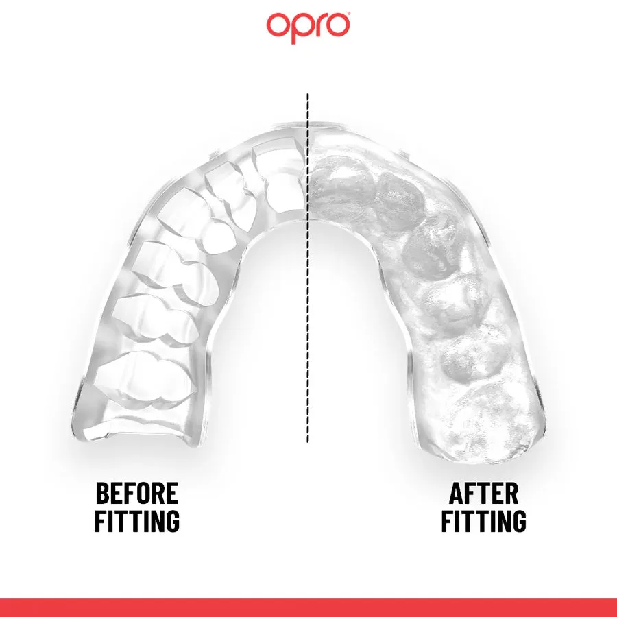 OPRO Instant Custom Fit Tannbeskytter